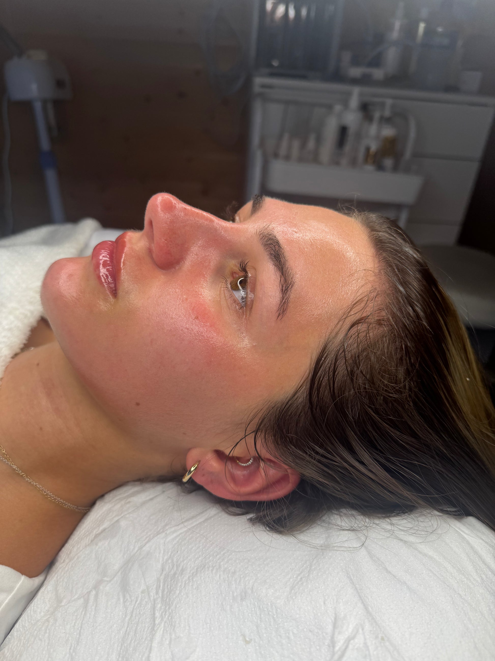 BioRePeel + Dermaplane & LED