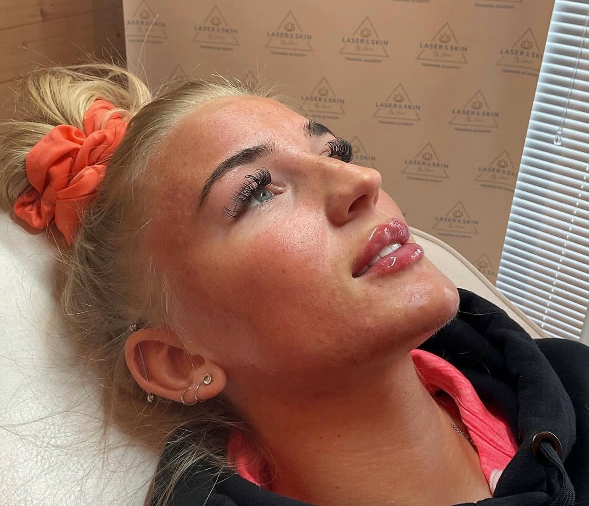 Chin, Cheek & Jaw Filler