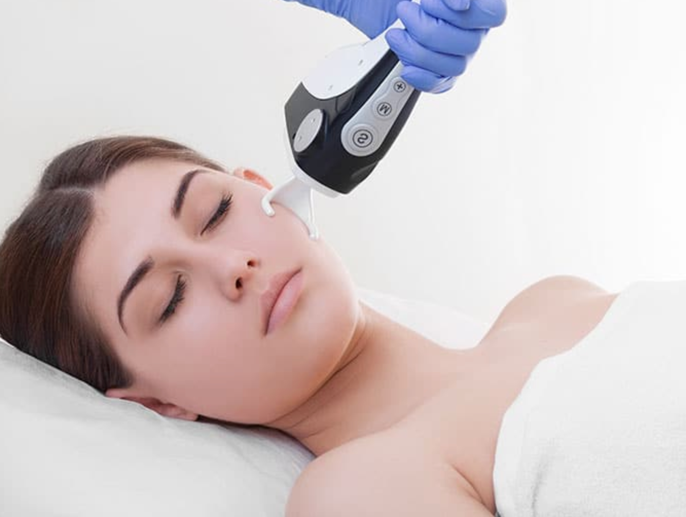 CO2 Laser Skin Resurfacing