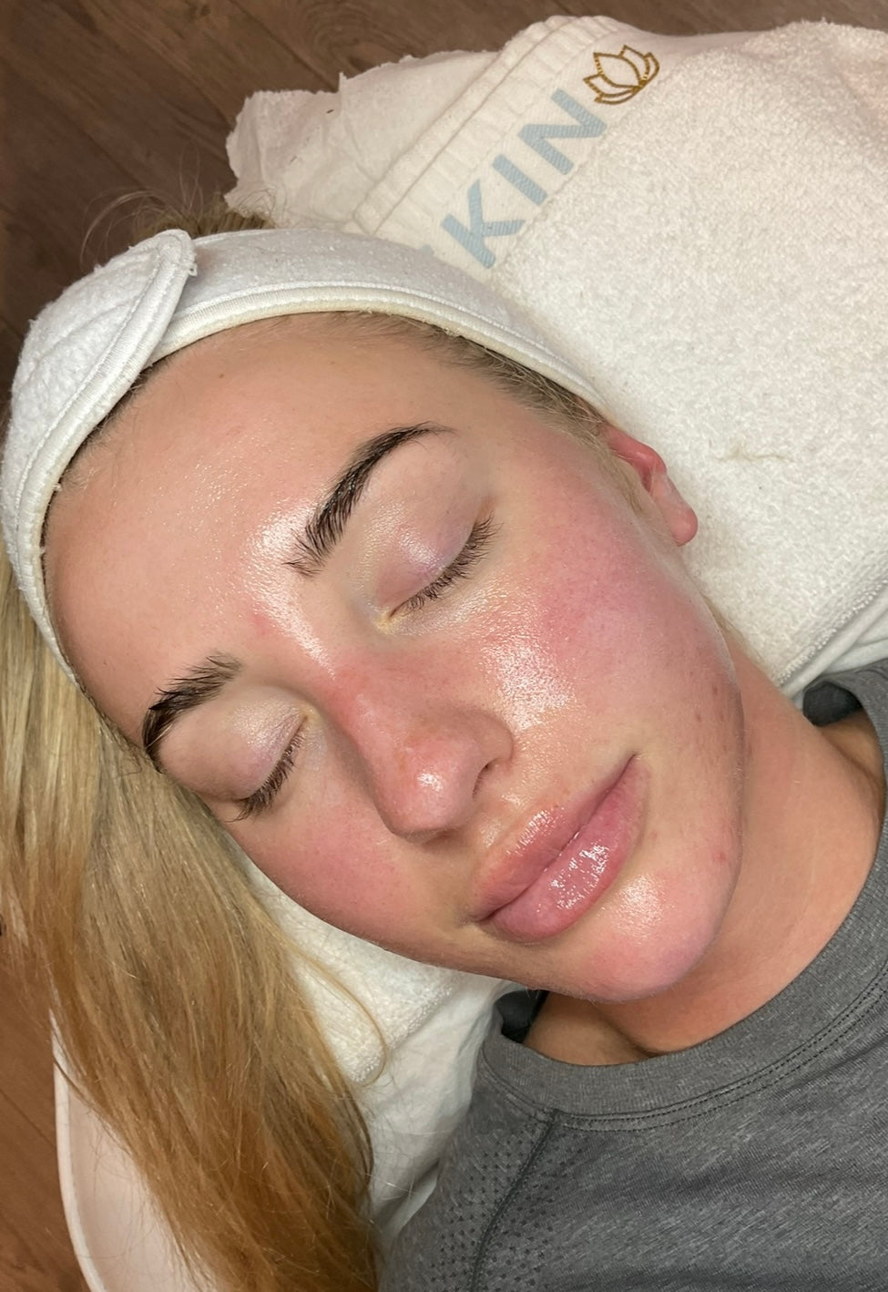 Dermaplaning Facial