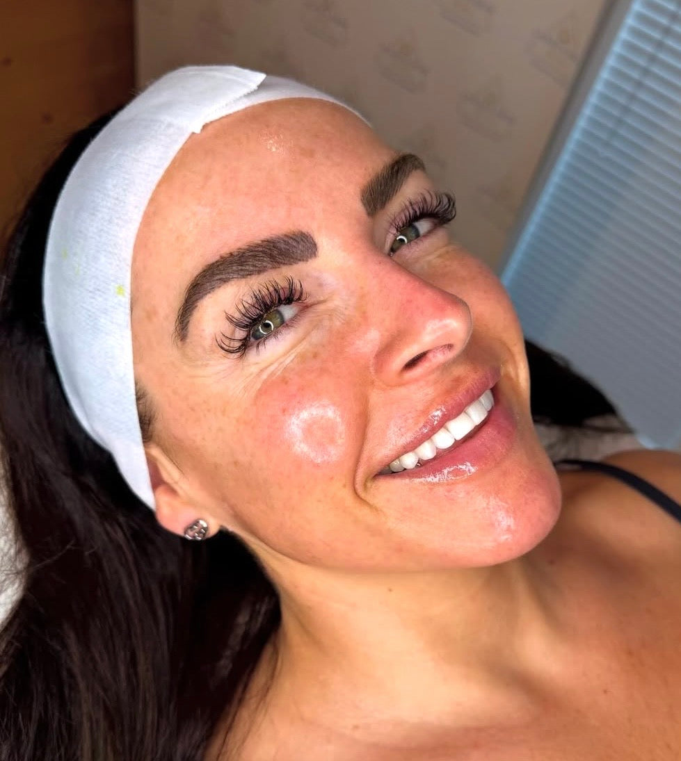 Microneedling + Dermaplaning