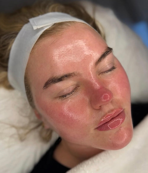 Algae Peel + Dermaplane