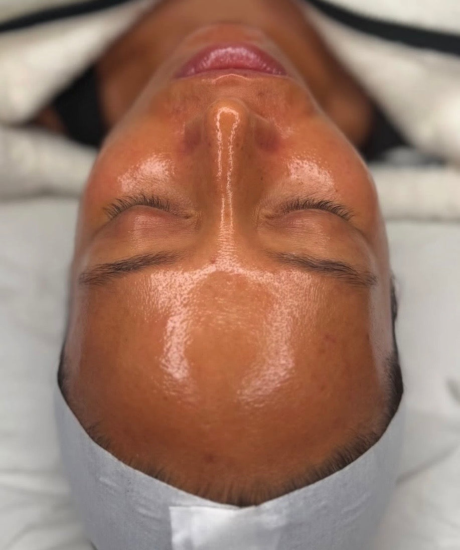 Microdermabrasion + Peel & Dermaplane