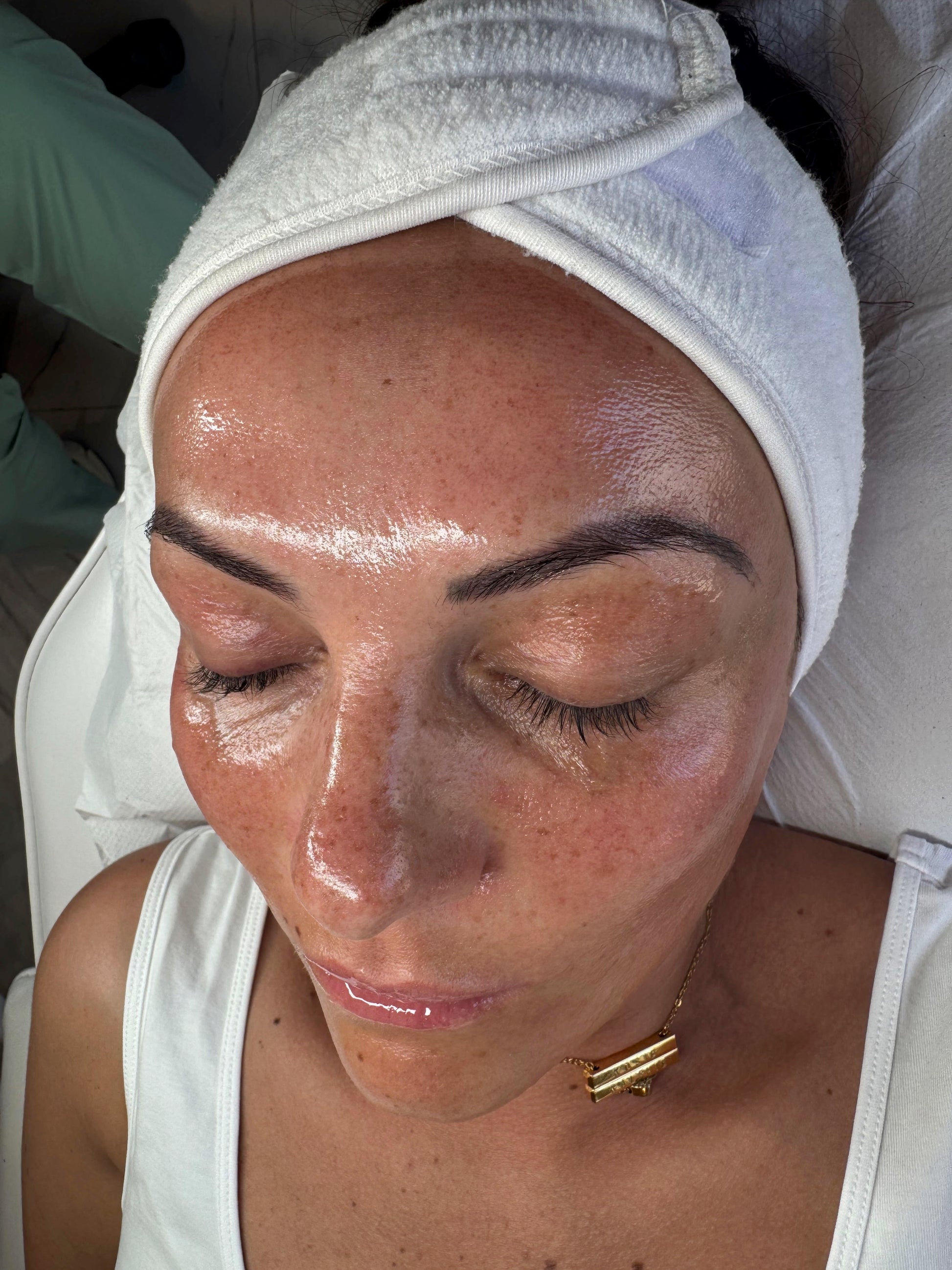 CLINICCARE Chemical Peel